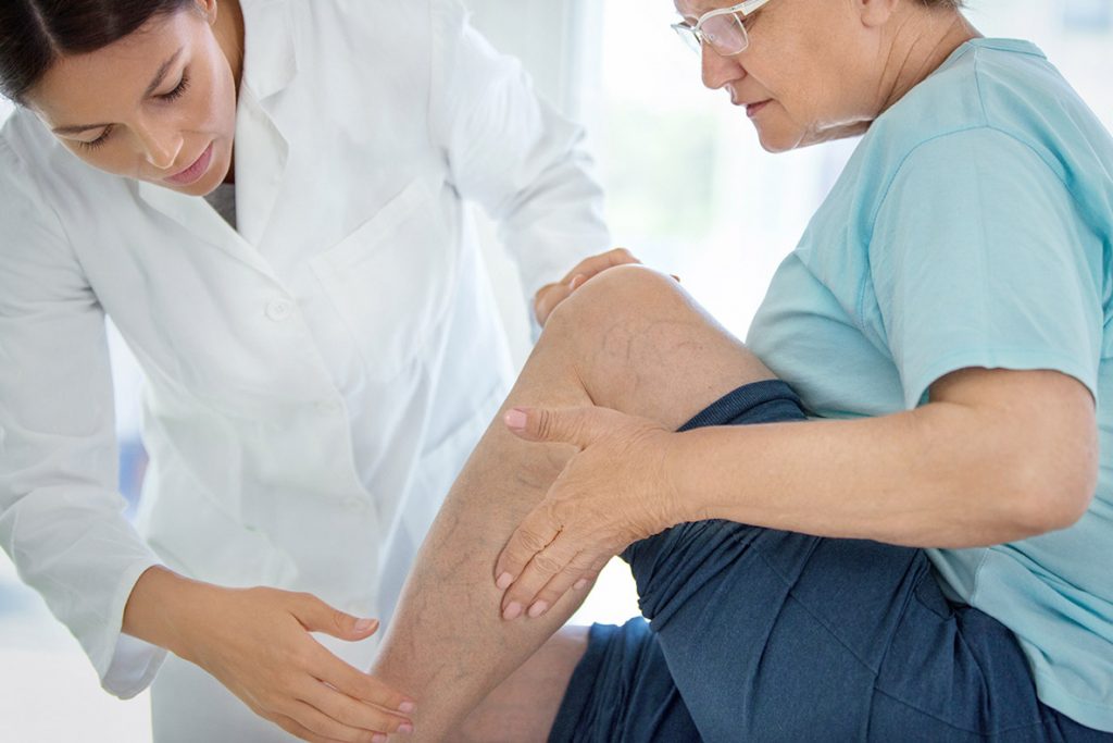 a doctor examining the knee of a senior women that is having circulation issues